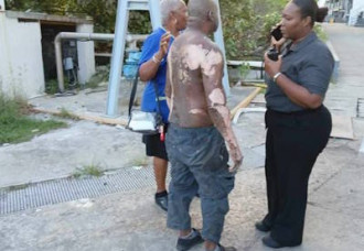  Resort employee suffers severe burns during maintenance work.