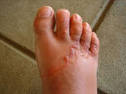 footworm10062013