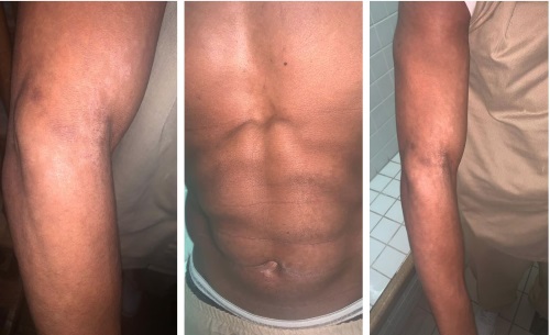 skinrashes24102019