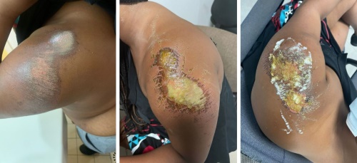 injuries27052021