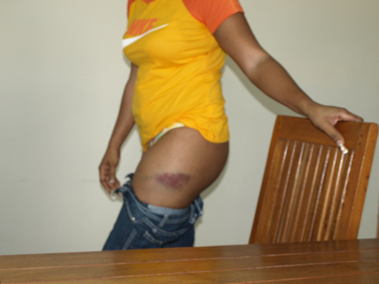 injury